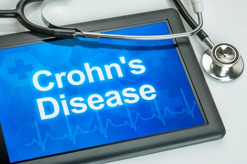 Crohn's Disease