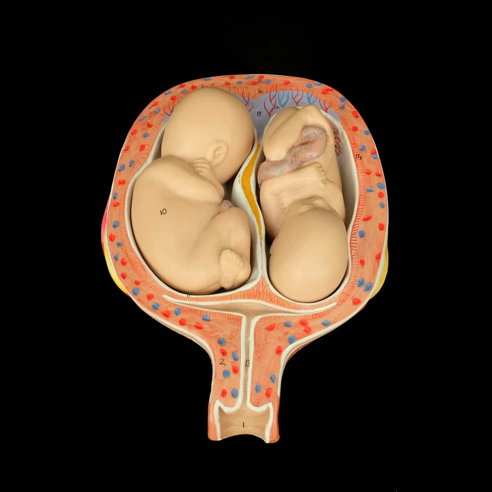 Understanding Twin Twin Transfusion Syndrome Mfm In New York City