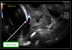 Maternal Fetal Medicine New York Ultrasound