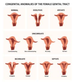 uterine anomalies mfm nyc