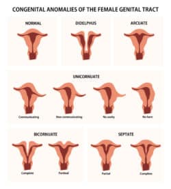 Uterine Anomalies - OB-GYN New York