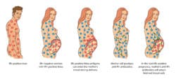 Understanding Fetal Anemia